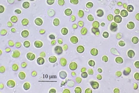 Chlorella-vulgaris Chlorella-vulgaris